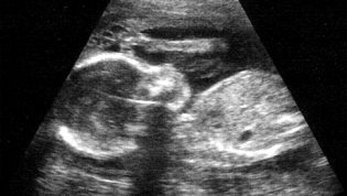 Lire la suite à propos de l’article L’élimination prénatale des filles s’étend en Asie, aux Etats-Unis et en Europe