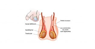 Lire la suite à propos de l’article Les trois méthodes modernes de contraception masculine
